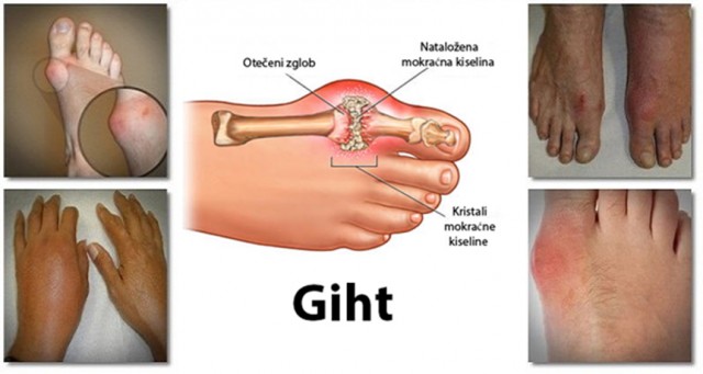 giht-foto-1 (1)