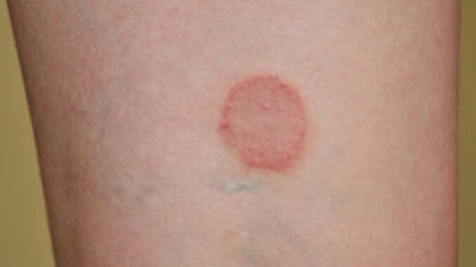 5f991577-b5e8-4ffb-95a3-2ab30a0a0a64-823cb52d5db14512915d14d2404b3c85-content-medium-690x480