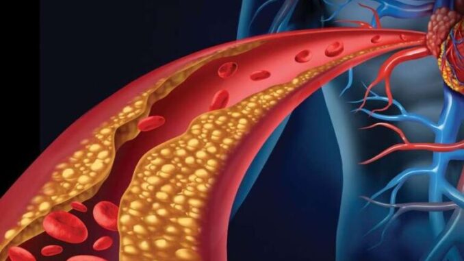 1766335635-holesterol-872x610-690x480-1-768x511